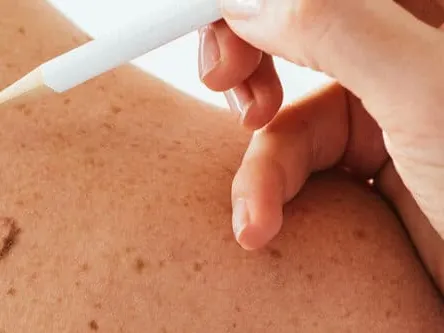 Mole Removal Fredericksburg TX
