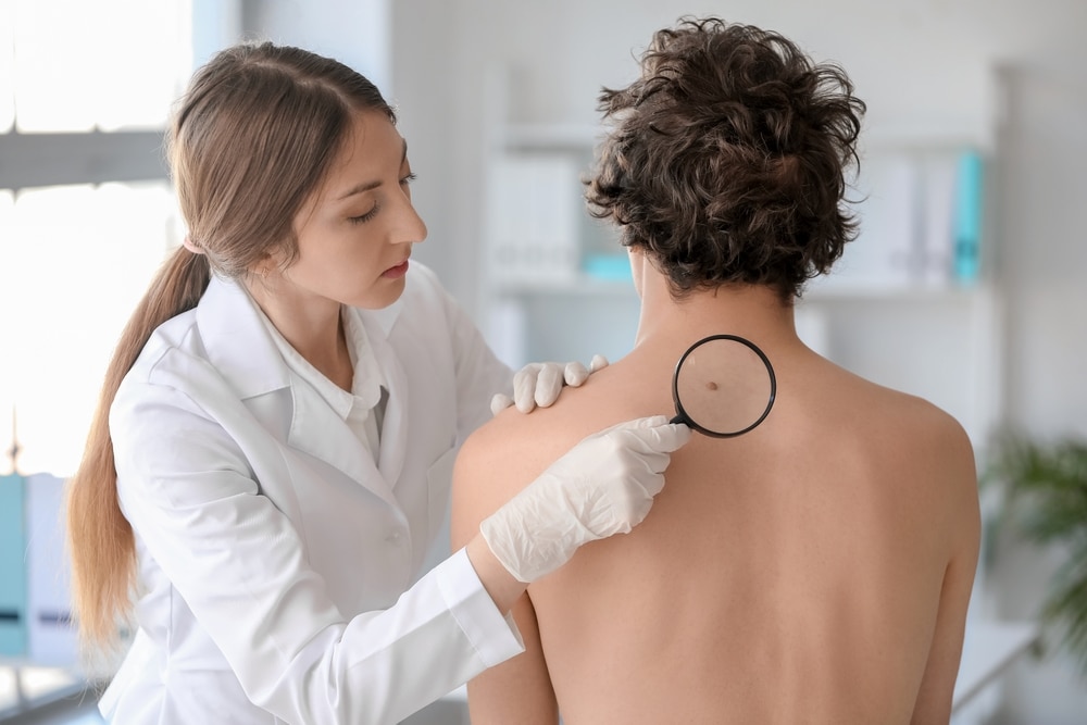 Dermatologist examining a patient's mole on their back in search of possible skin cancer.